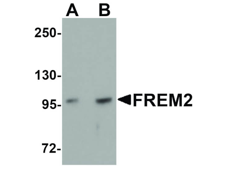 Western Blot of FREM2 Antibody