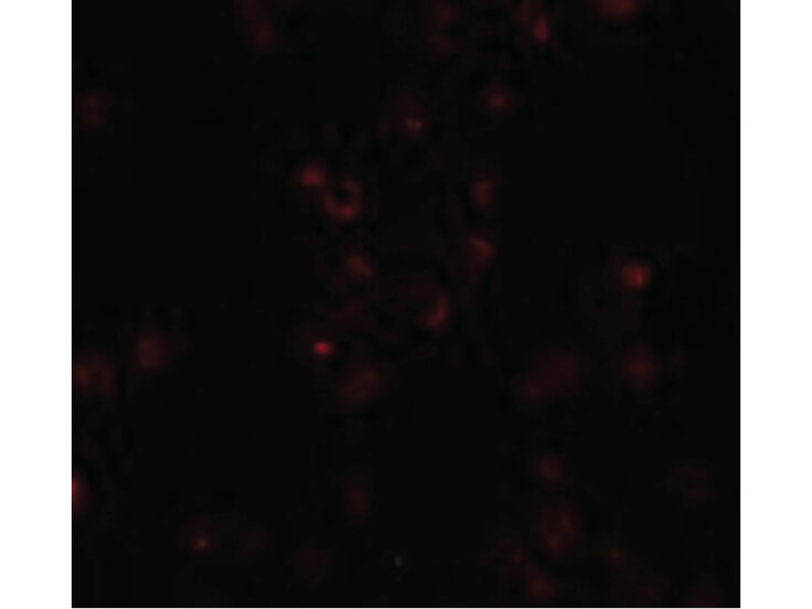Immunofluorescence of FREM2 Antibody