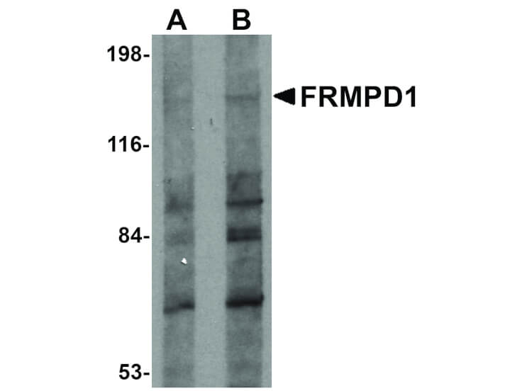 Western Blot of FRMPD1 Antibody