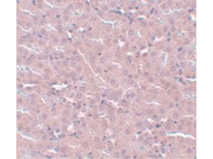 Immunohistochemistry of FRMPD2 Antibody