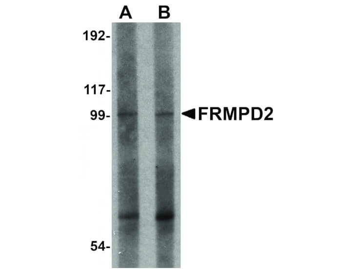 Western Blot of FRMPD2 Antibody