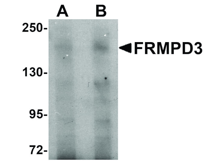 Western Blot of FRMPD3 Antibody