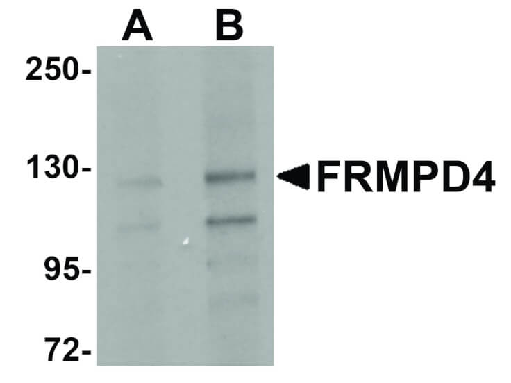 Western Blot of FRMPD4 Antibody