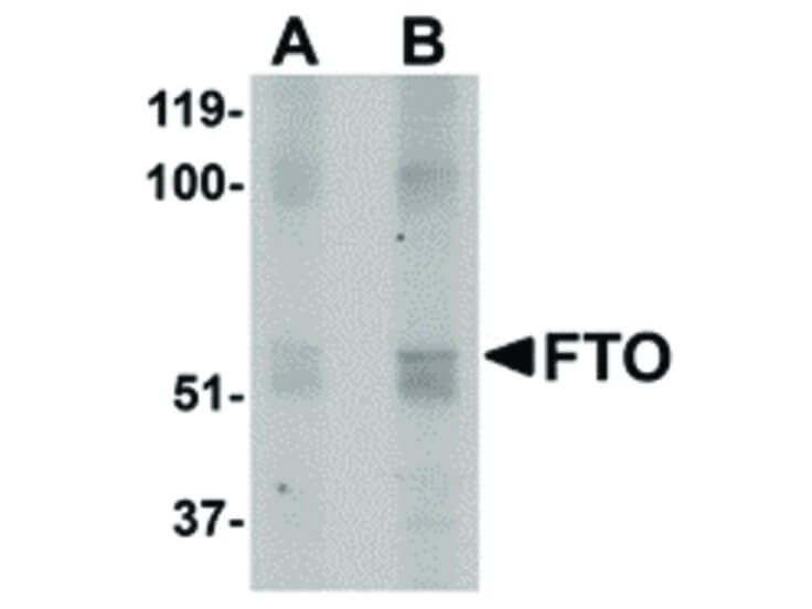 Western Blot of FTO Antibody
