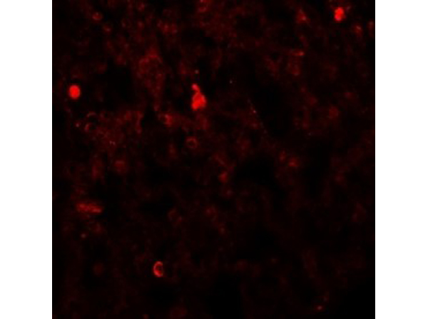 Immunofluorescence of FXYD4