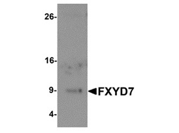 Western blot analysis of FXYD7