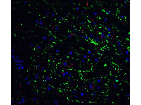 Immunofluorescence of GABARAP