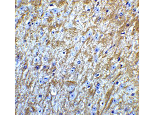 Immunohistochemistry of GABARAP