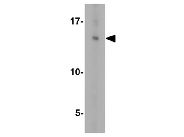 Western blot of GABARAP