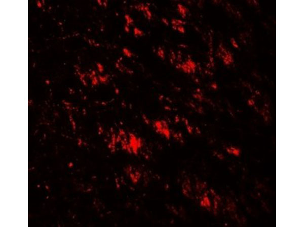 Immunofluorescence of GABARAP