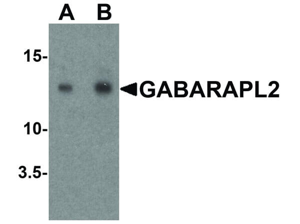 Western Blot of GABARAPL2 Antibody