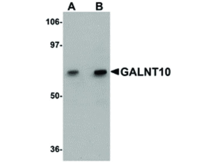 Western Blot of GALNT10 Antibody