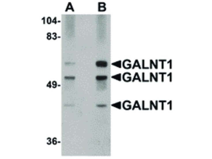 Western Blot of GALNT10 Antibody