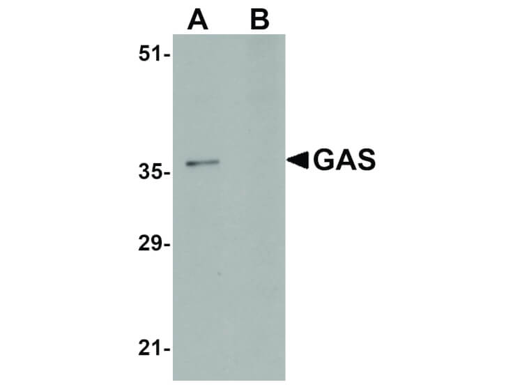 Western Blot of GAS Antibody