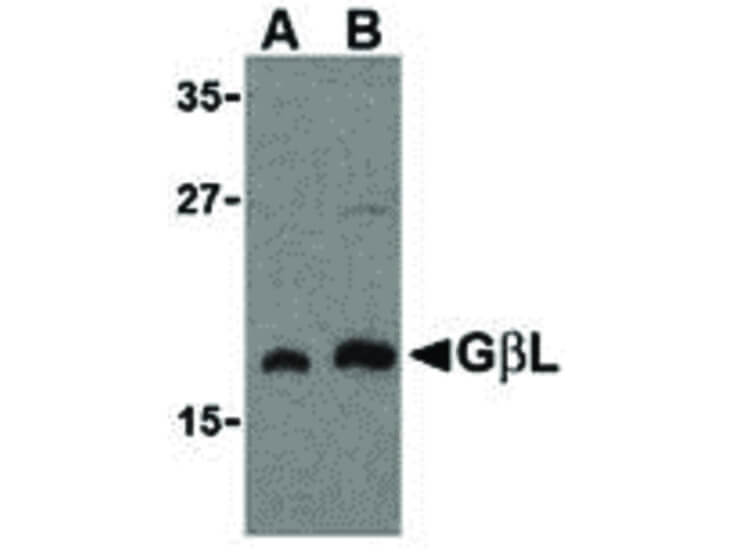 Western Blot of GBL Antibody