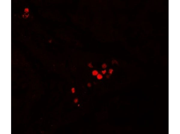 Immunofluorescence of GBP5