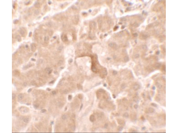 Immunohistochemistry of GBP5