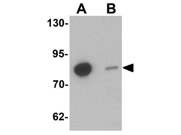 Western blot results of Anti-GBP6 antibody