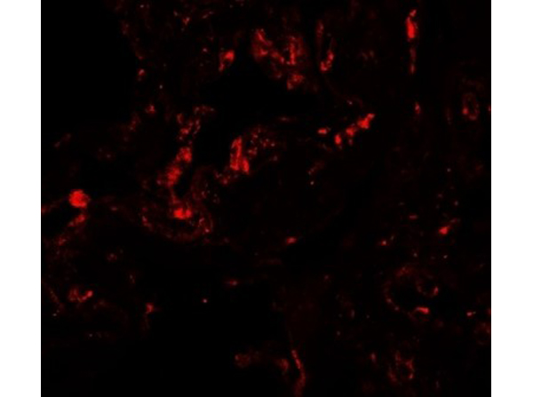 Immunofluorescence of GDF1