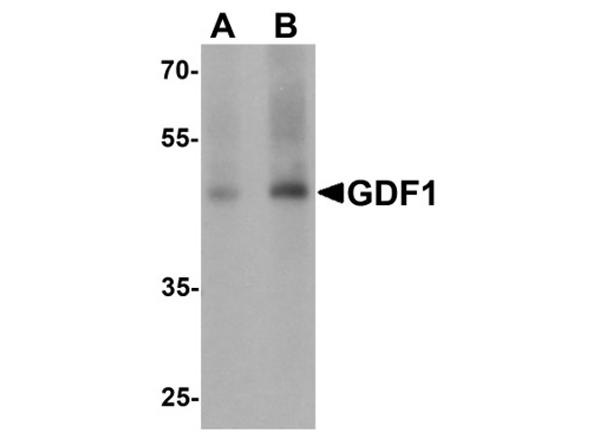 Western blot analysis of GDF1