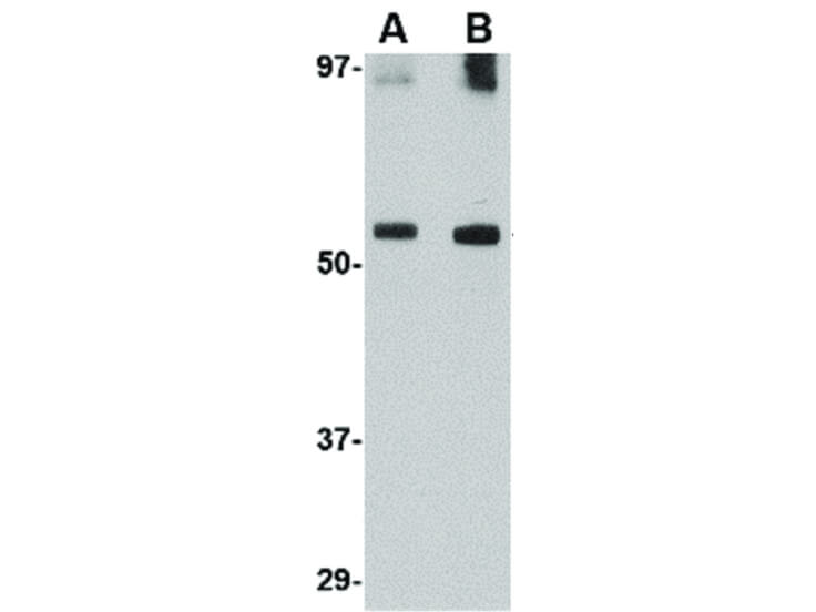 Western Blot of GDF6 Antibody