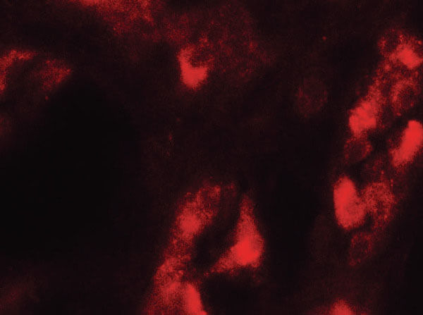Immunofluorescence of GDPD5 Antibody