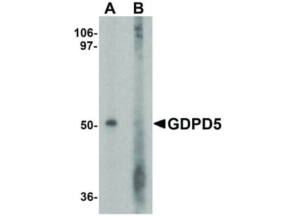 Western Blot of GDPD5 Antibody