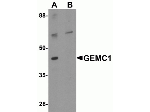 Western blot analysis of GEMC1