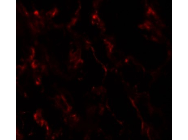Immunofluorescence of GHDC