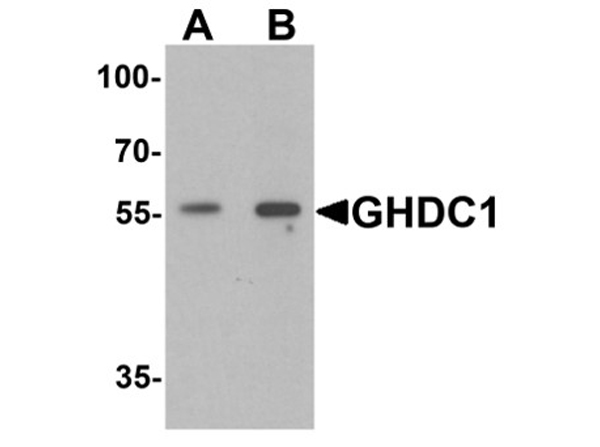 Western blot analysis of GHDC