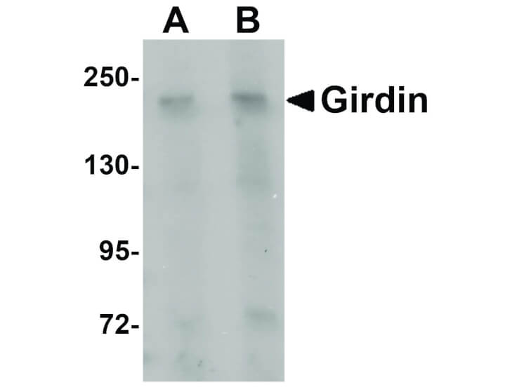 Western Blot of Girdin Antibody