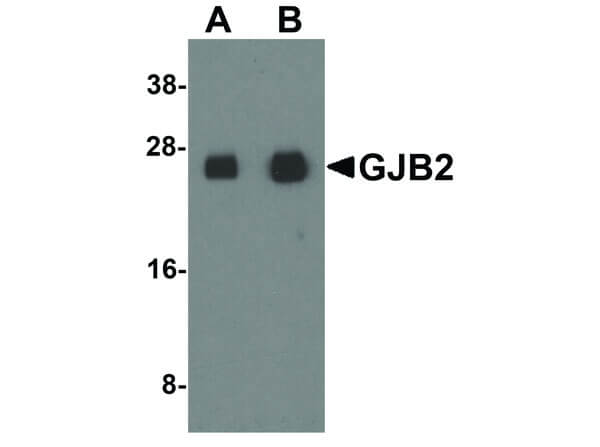 Western Blot of GJB2 Antibody