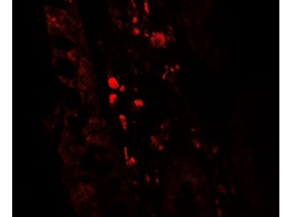 Immunofluorescence of GLIPR1