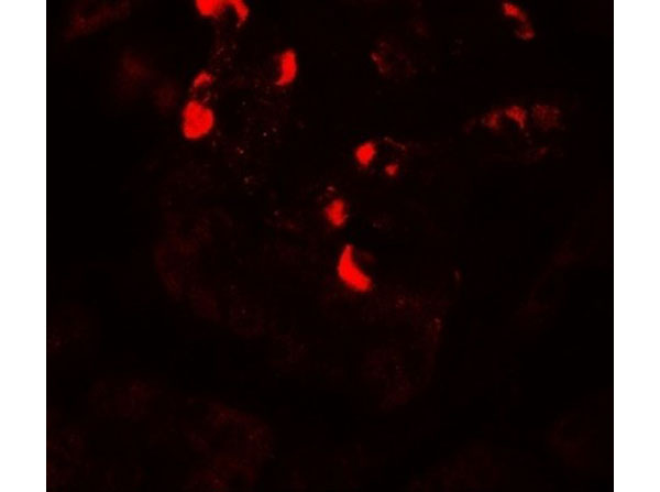 Immunofluorescence of GLIPR1L1