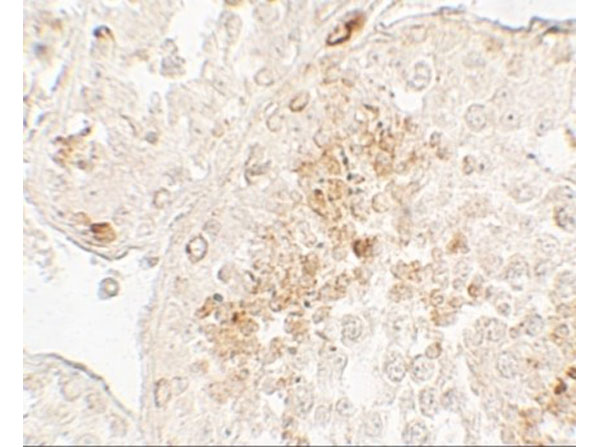 Immunohistochemistry of GLIPR1L1