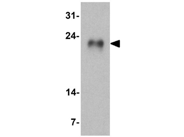Western blot of GLIPR1L1