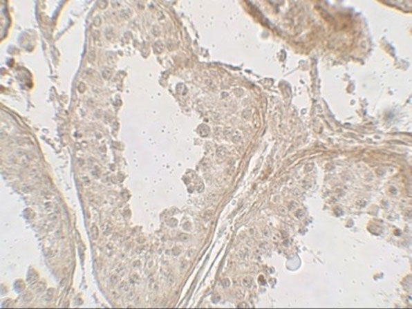 Immunohistochemistry of GLIPR1L2