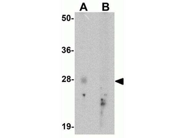 Western blot analysis of GLIPR1L2