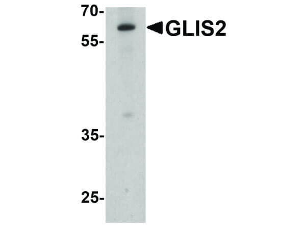 Western Blot of GLIS2 Antibody