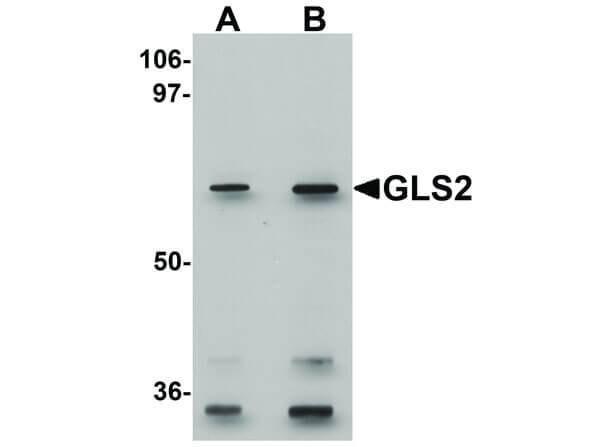 Western Blot of Rabbit anti-GLS2 antibody