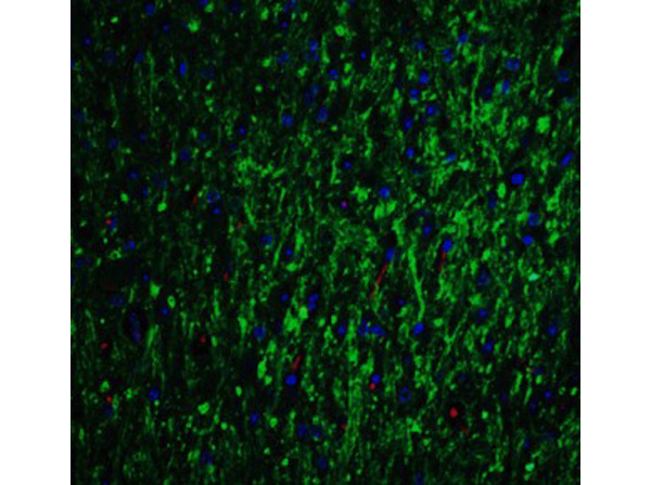 Immunofluorescence Validation of GLS2