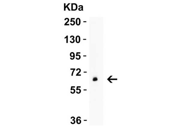 Western Blot Validation of GLS2