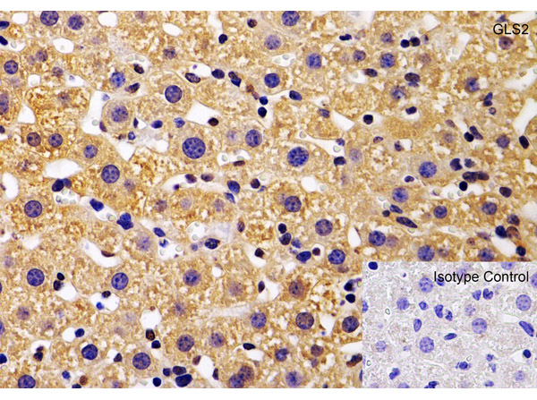 Immunohistochemistry Validation of GLS2