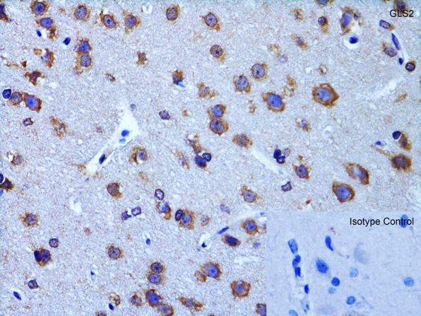 Immunohistochemistry Validation of GLS2