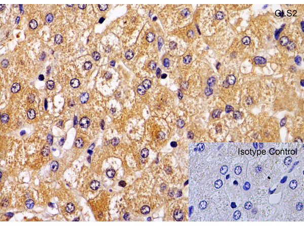 Immunohistochemistry Validation of GLS2