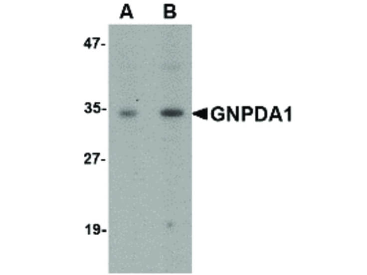 Western Blot of GNPDA1 Antibody