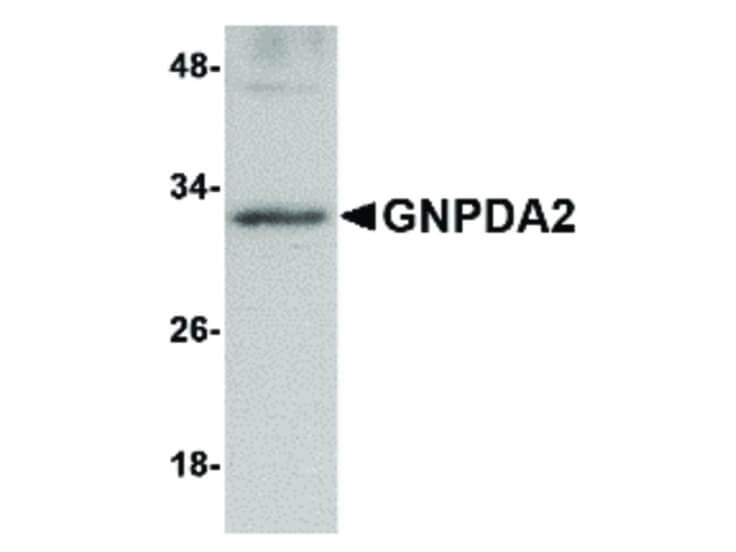 Western Blot of GNPDA2 Antibody