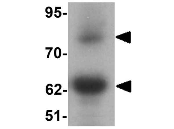 Western blot of GOLGA5