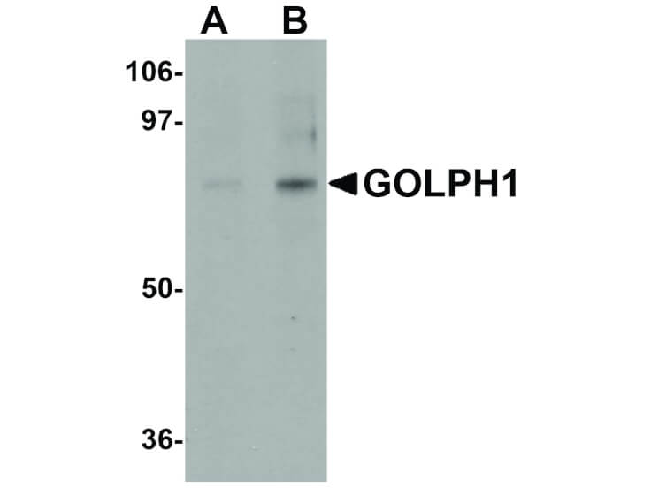 Western Blot of GOLPH1 Antibody