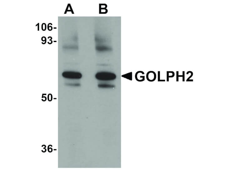 Western Blot of GOLPH2 Antibody